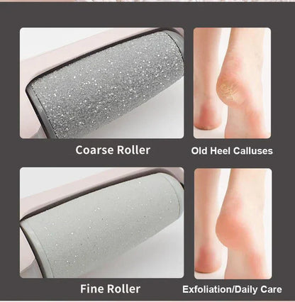 Foot File Callus Remover